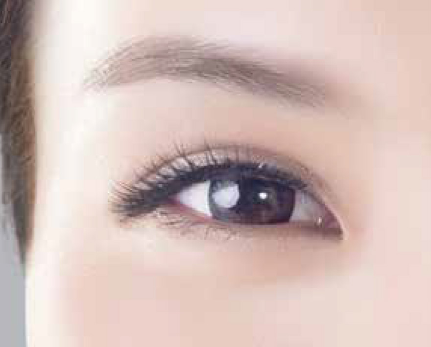 Close-up of a woman's eye and brow for Endolift laser skin lifting in London
